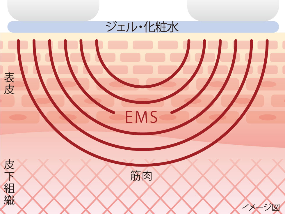 クロス付き