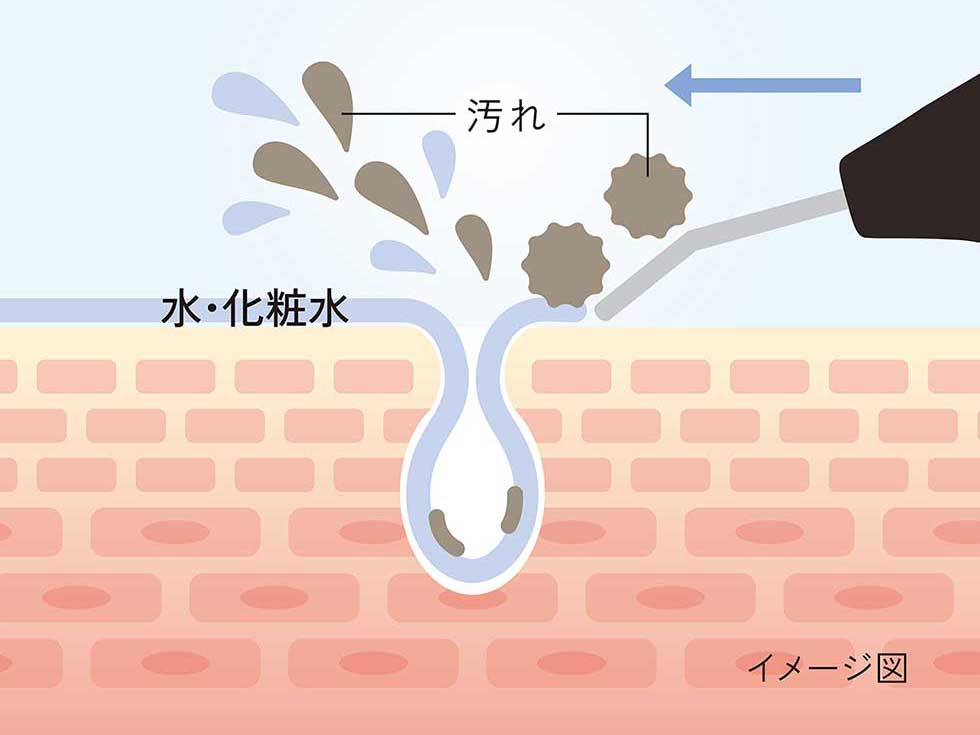 エナージュ ENAGE エステ 超音波ピーリング 化粧水や水を塗って肌をすべさせるだけ