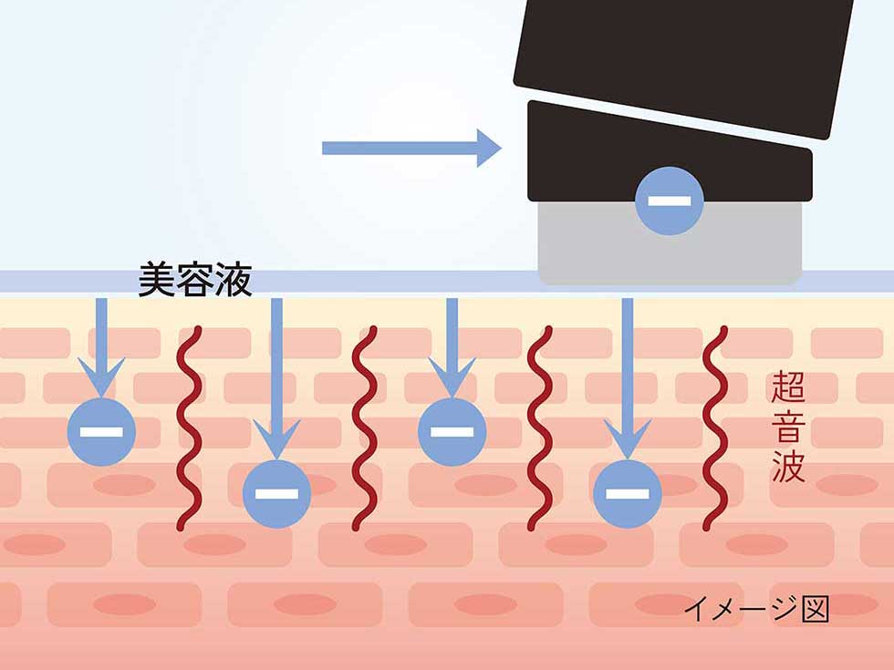 エナージュ ENAGE エステ 超音波ピーリング 美容成分を角質層まで浸透